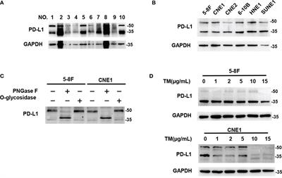 TGF-β1-Mediated PD-L1 Glycosylation Contributes to Immune Escape via c-Jun/STT3A Pathway in Nasopharyngeal Carcinoma